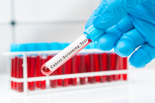 a testube containing a red liquid with the label 'Cancer Screening Test'